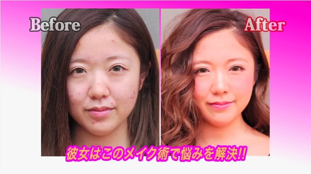 肌荒れの女の子