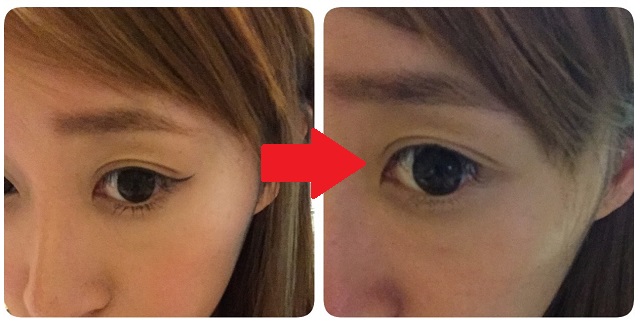 ビオデルマクレンジング水