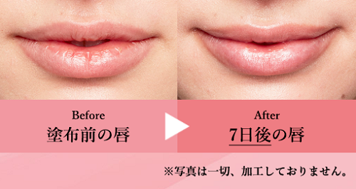 LIP38℃